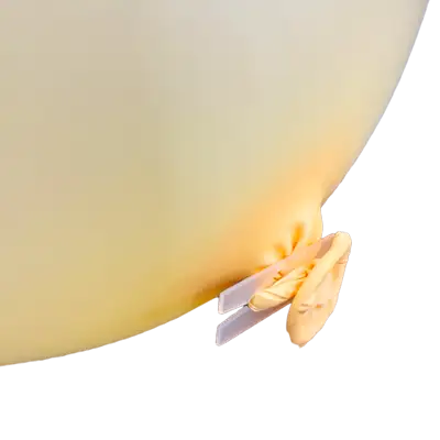 バルーンクリップ使用イメージ